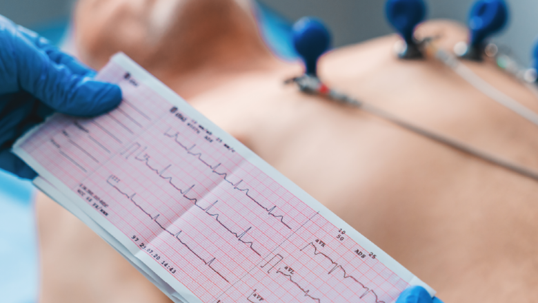 <span style="font-weight: bold;">ЭКГ</span>